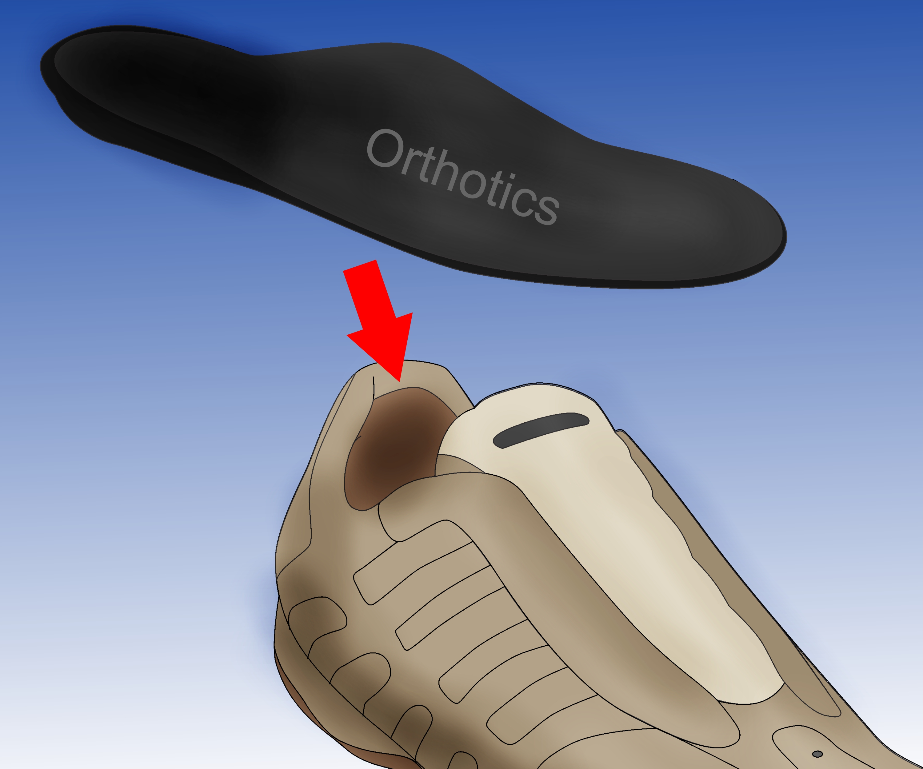 3 Ways to Prevent Shin Splints wikiHow