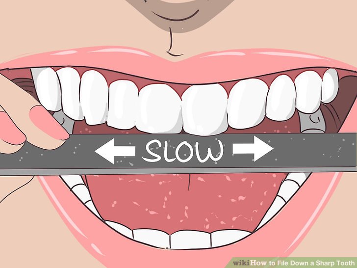 4 Ways to File Down a Sharp Tooth wikiHow