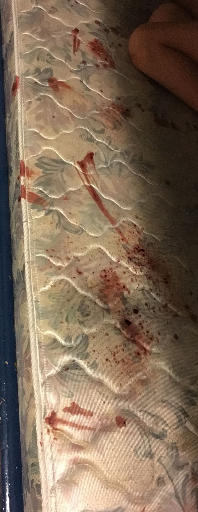 The Best Way to Remove Blood Stains from a Mattress wikiHow