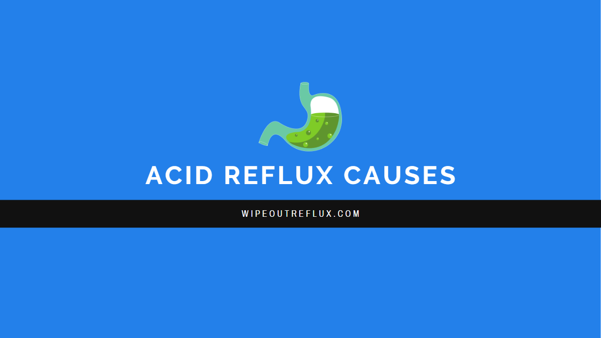 Acid Reflux / GERD The Ultimate Guide