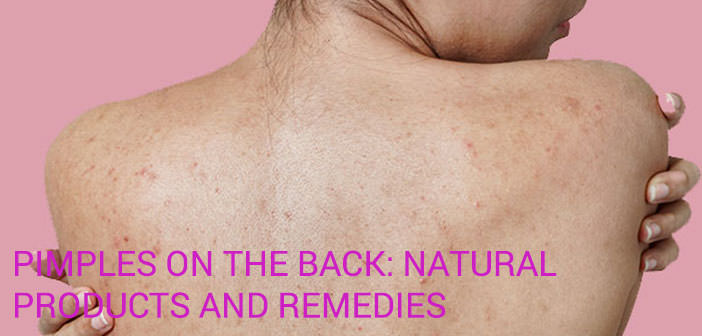 Pimples on the back natural products and remedies to eliminate them