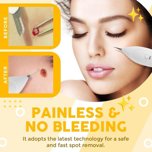 Spot Removal Pen (Only Today Special Offer 75 Off) Wizzgoo