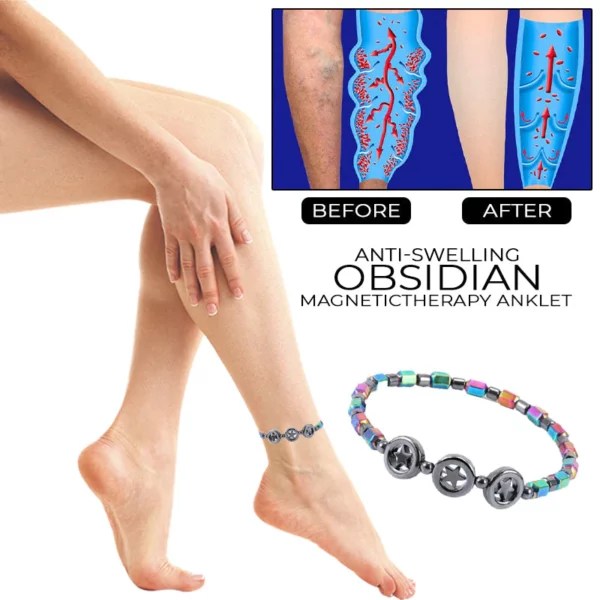 AntiSwelling Obsidian Anklet