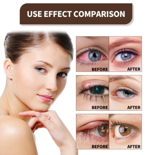 EYELIGHT™ Ultra Eye Therapy Lubricant Eye Drops