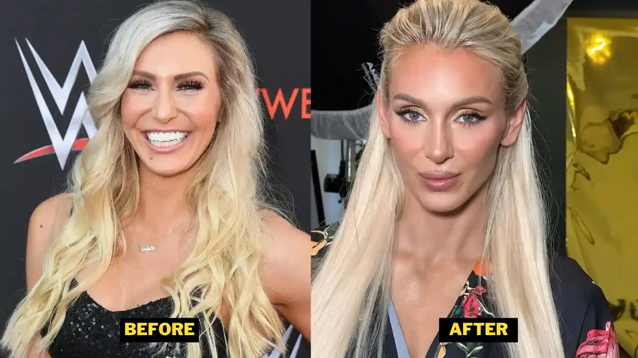 Charlotte Flair Plastic Surgery 2023. Dental, Breast Implants, And New