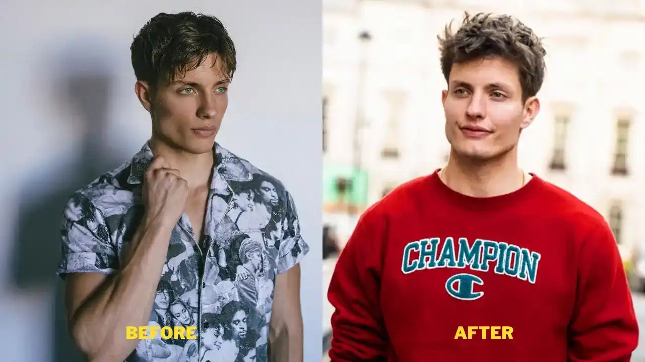 Matt Rife Plastic Surgery & Weight Loss. Glow Up And Before After Pictures.