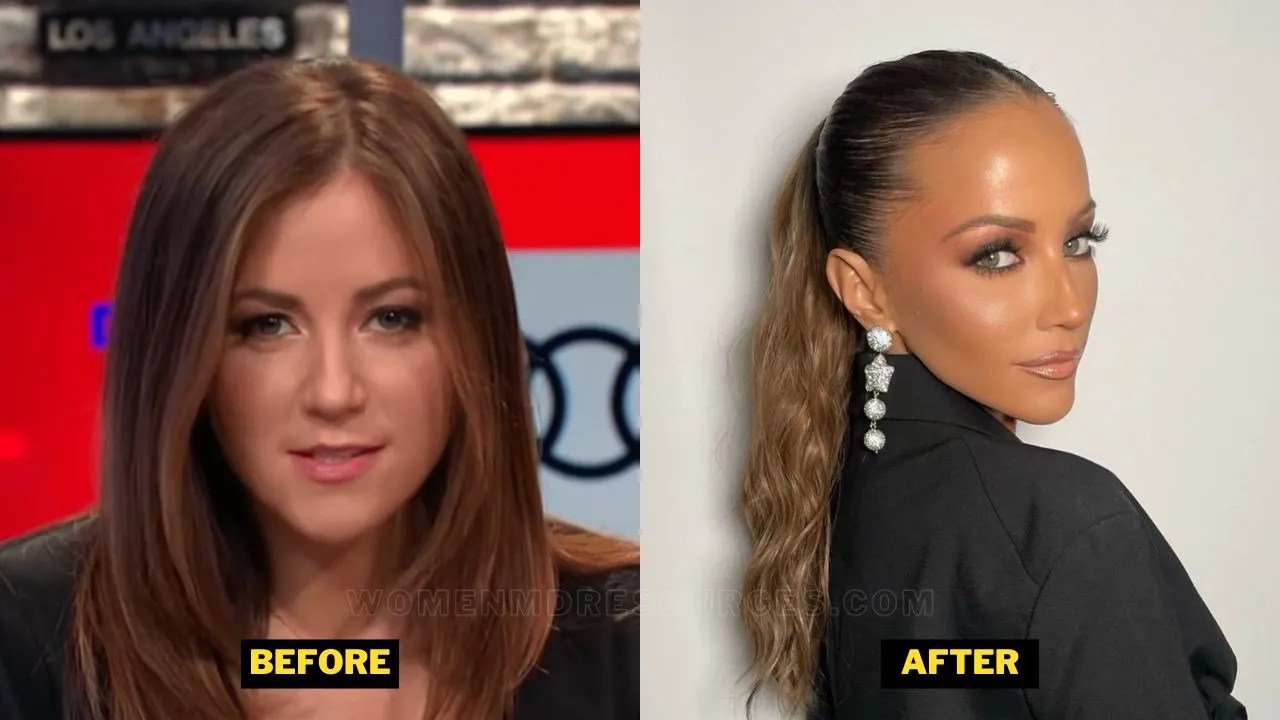 Kay Adams Plastic Surgery Rumours, Nose Job, Career, And Relationship