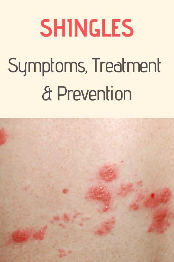 Shingles (Herpes Zoster) Symptoms, Treatment & Prevention Women's