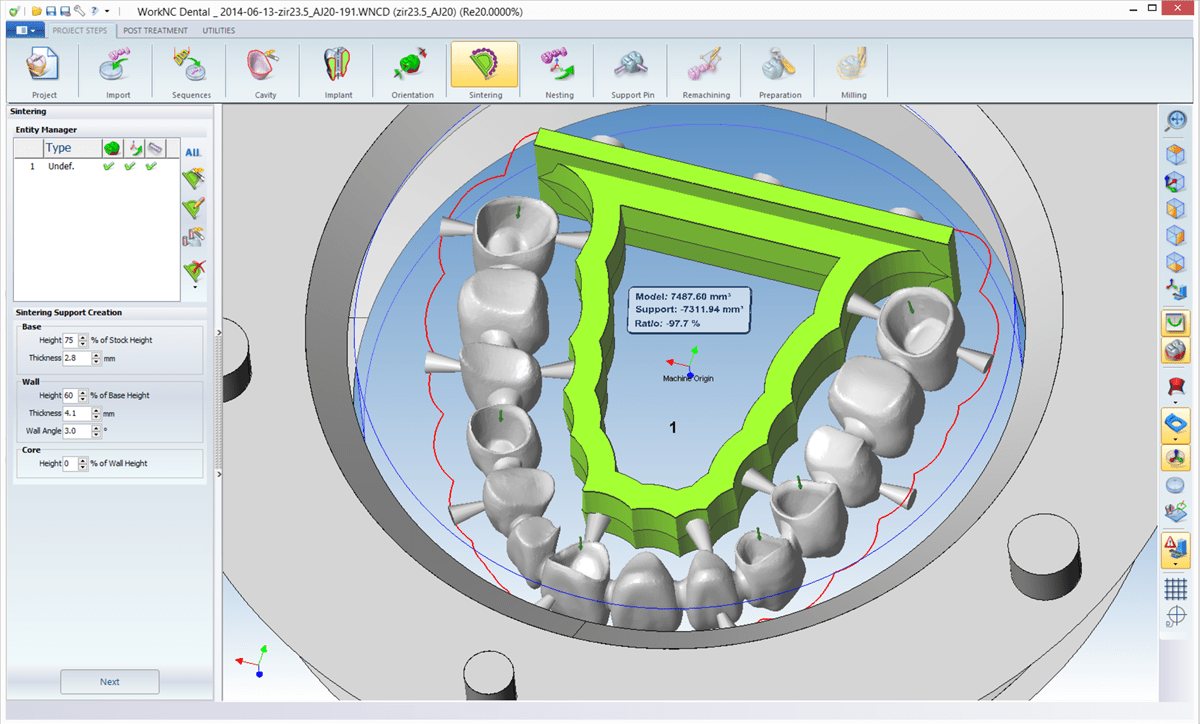 WORKNC DENTAL Automatic Preparation