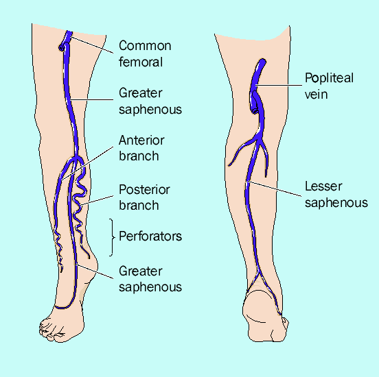 Compression hosiery in the prevention and treatment of venous leg ulcers
