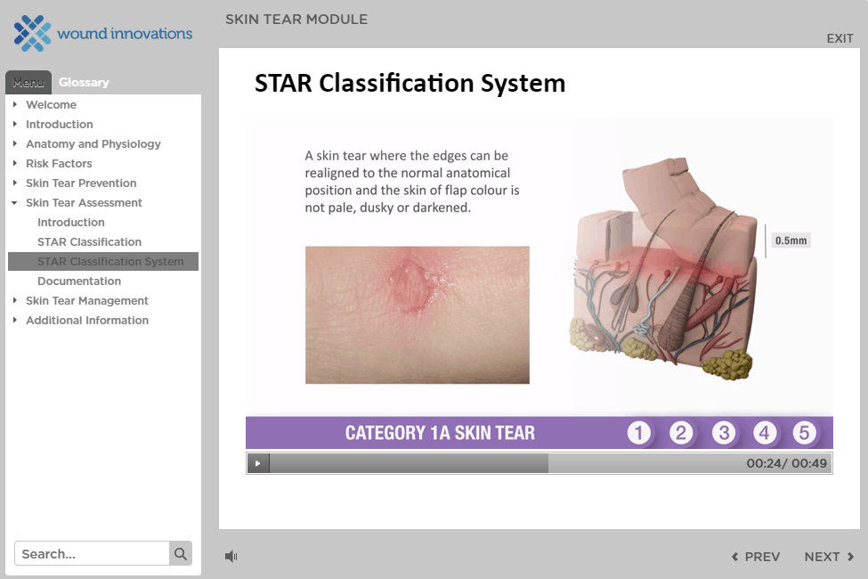 Star Wound Classification