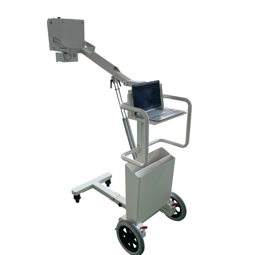 Previous Advantages of digital mobile x ray machine diagnosis and
