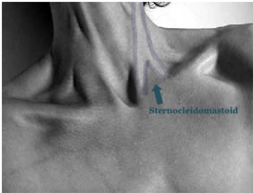 TRY THIS! SELF TREATMENT to release neck tension