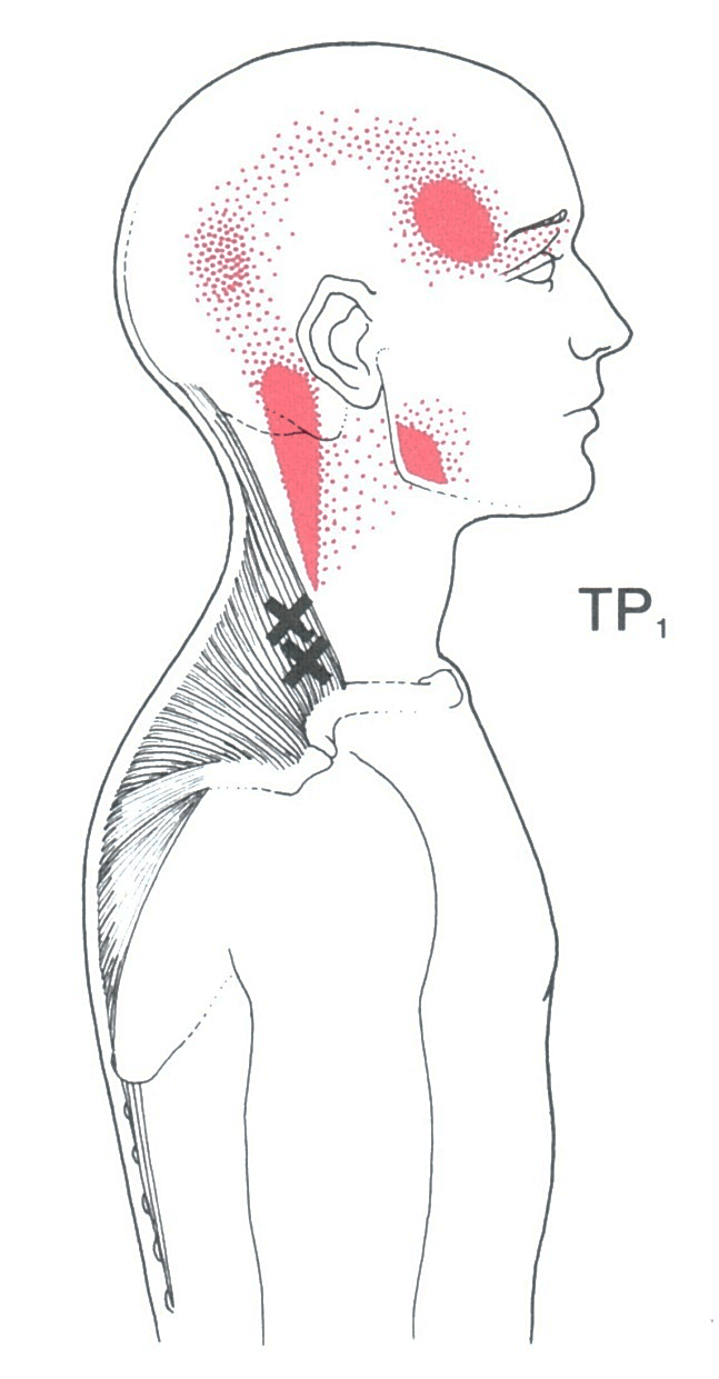 The Trapezius Muscle Yoganatomy