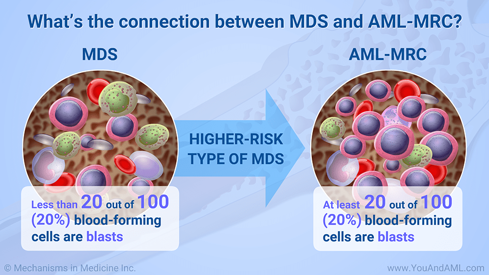 Slide Show Diagnosing AML, AMLMRC, and tAML