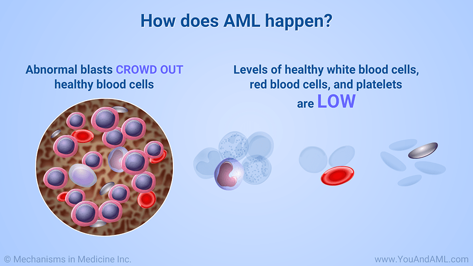 Slide Show Understanding AML