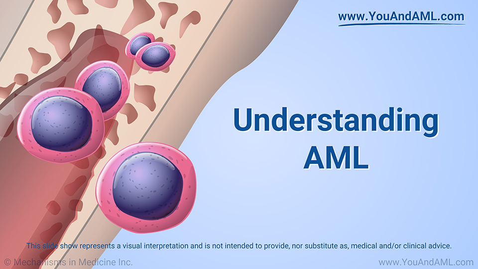 Slide Show Understanding AML