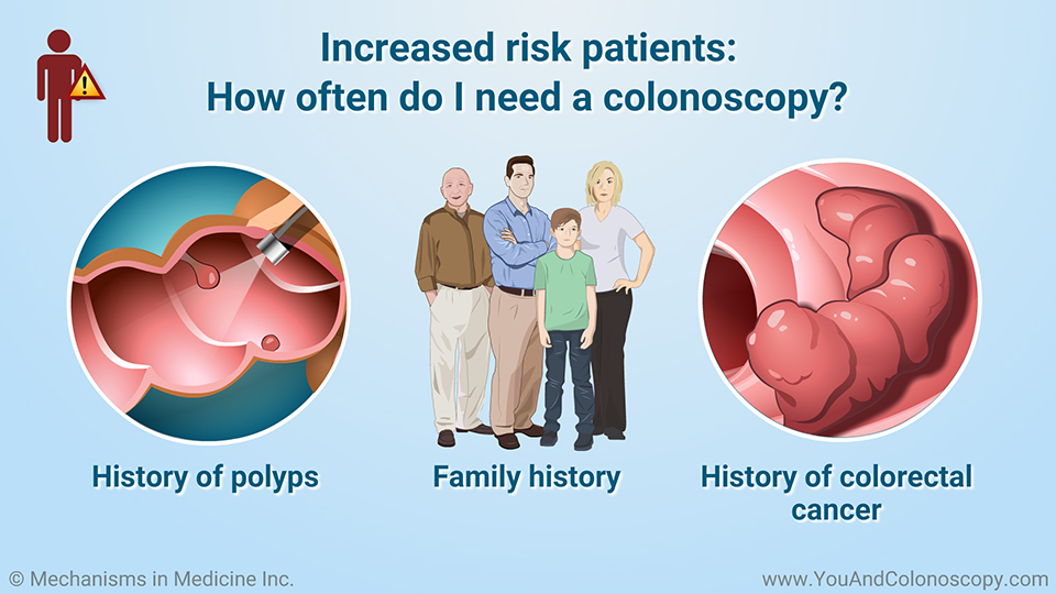 When should I get a colonoscopy and what do the results mean?