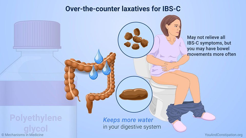 Slide Show Managing and Treating IBS with Constipation