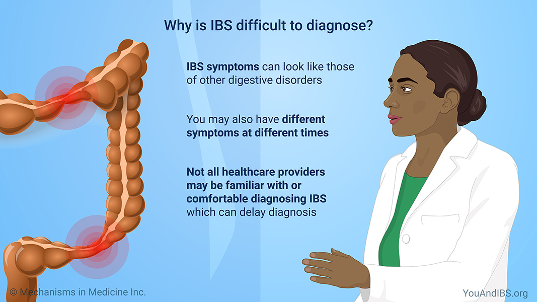 Slide Show Diagnosing Irritable Bowel Syndrome