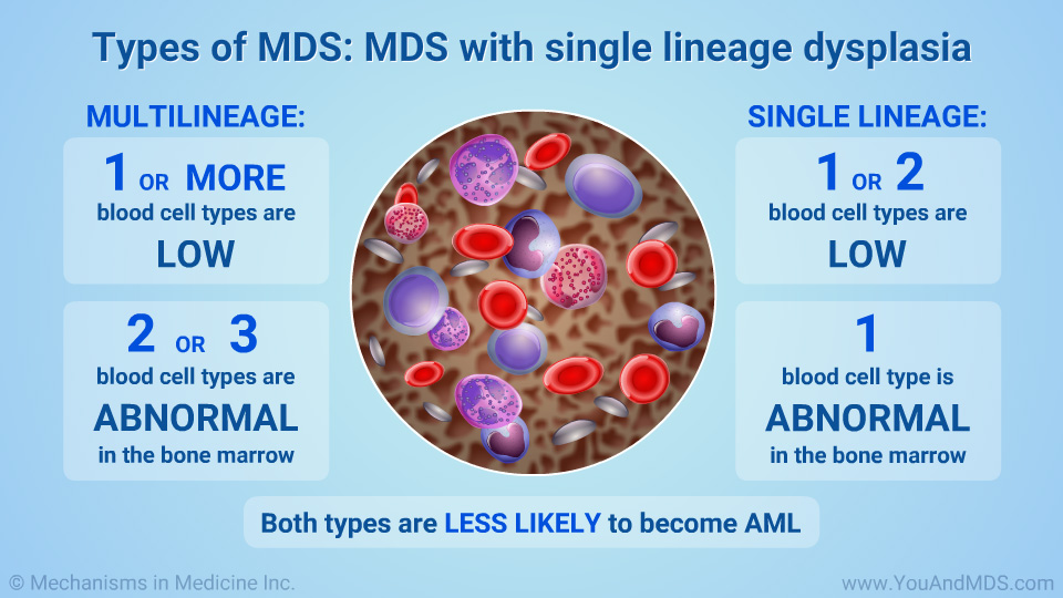 Slide Show Understanding MDSrelated Anemia