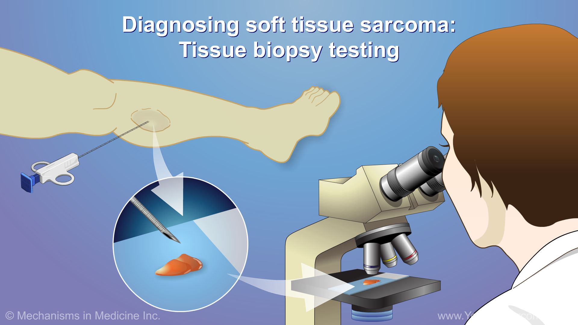 Diagnosing and Treating Soft Tissue