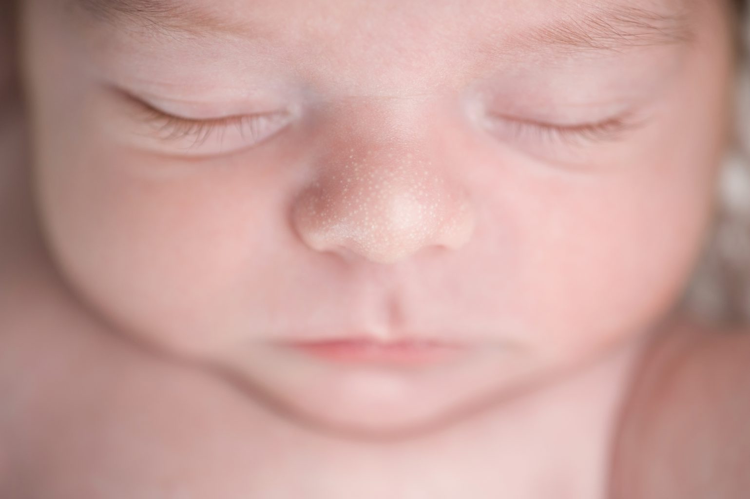 10 Common Newborn Baby Rashes You Need to Know About!