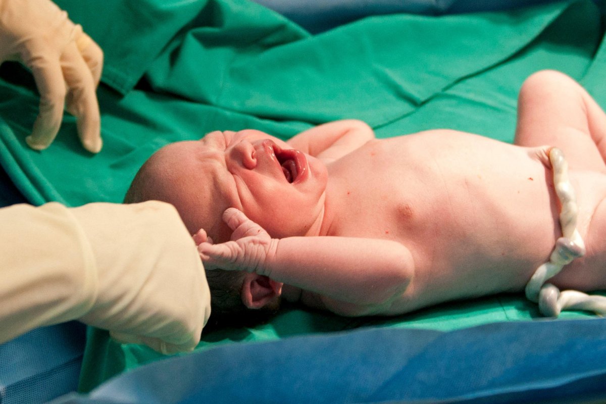 Nó no cordão umbilical, quais são os riscos?