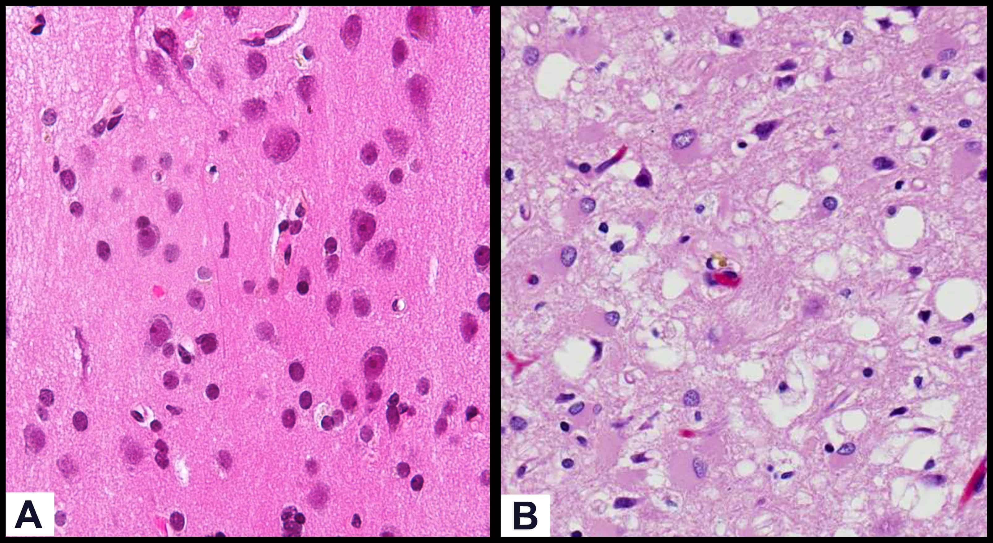 What are prions the confusing protein