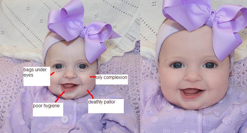 Ugly Baby