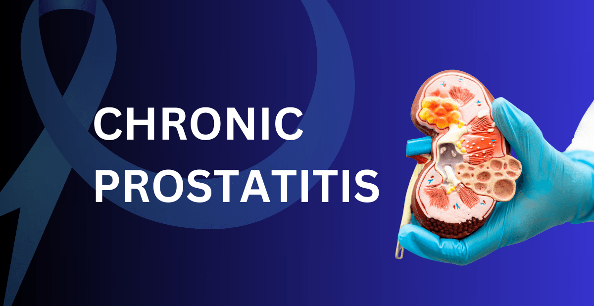 Chronic prostatitis Causes, symptoms, diagnosis, and treatment