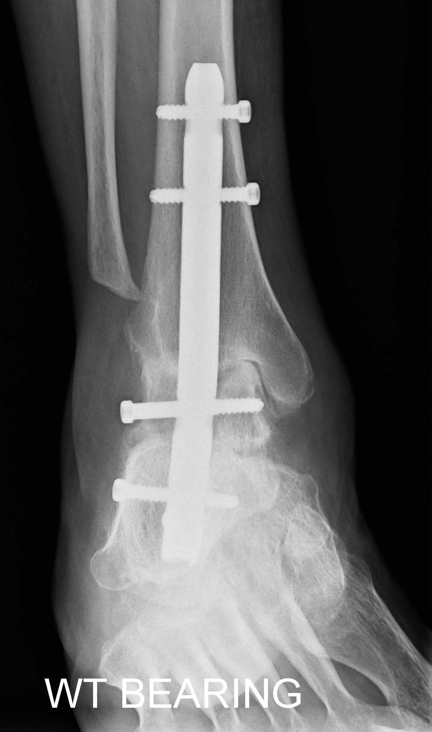 West Yorkshire Foot And Ankle Clinic