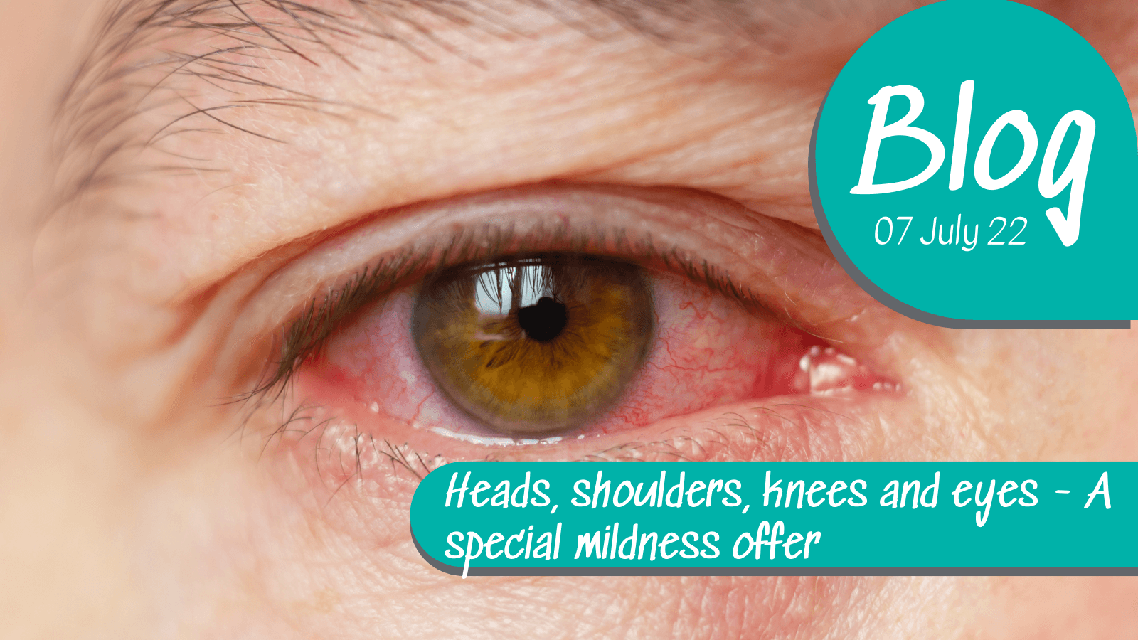 skin and eye irritation XCellR8