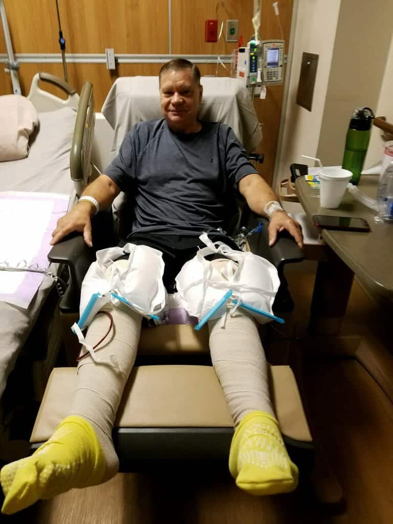 Double Knee Replacement, Double Manipulation Under Anesthesia