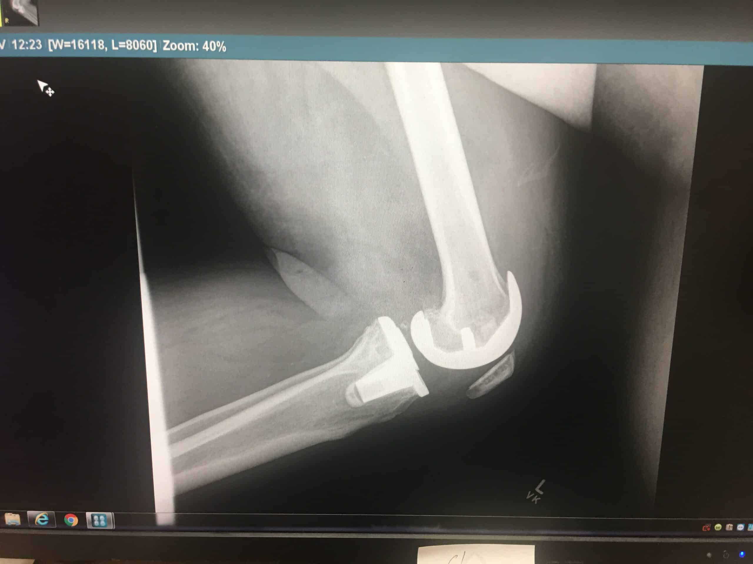 IMG_3019 X10 Therapy