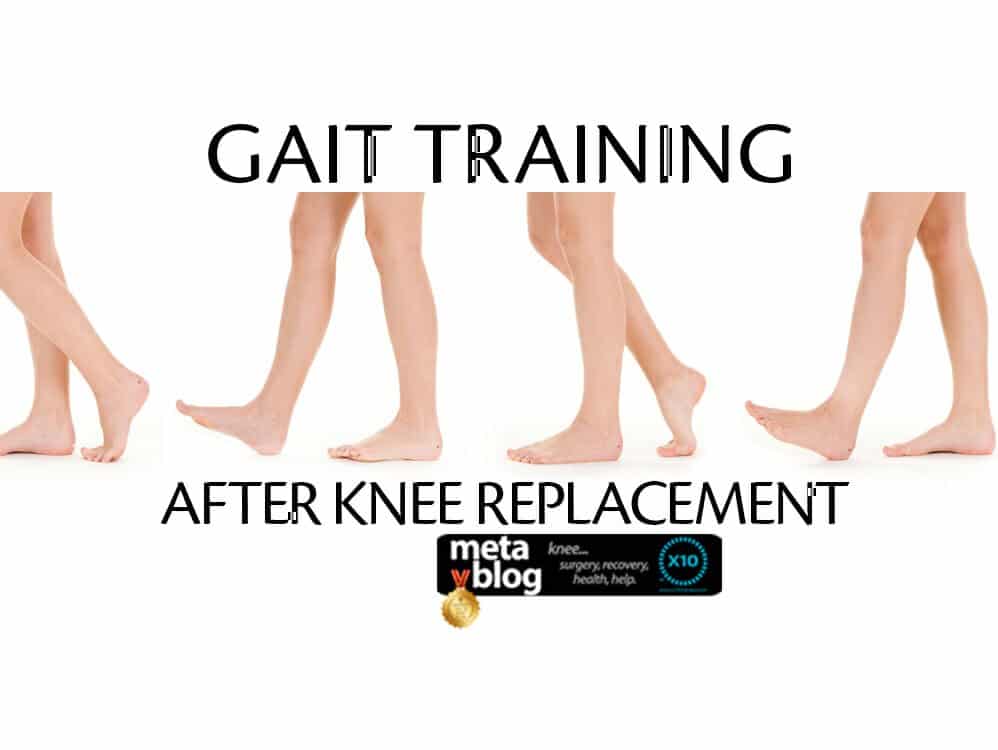 Gait Training After Knee Replacement X10 Therapy