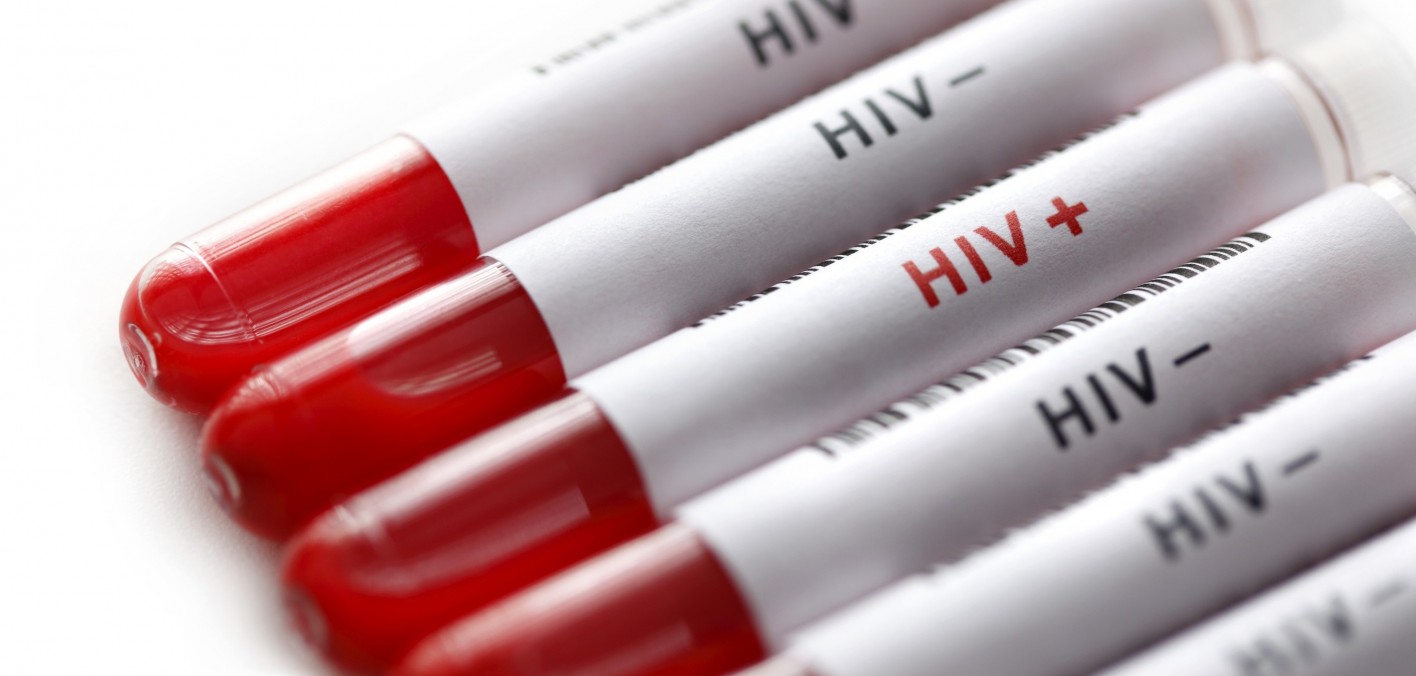 Breakthrough in HIV treatment one step towards viral eradication? X7 Research