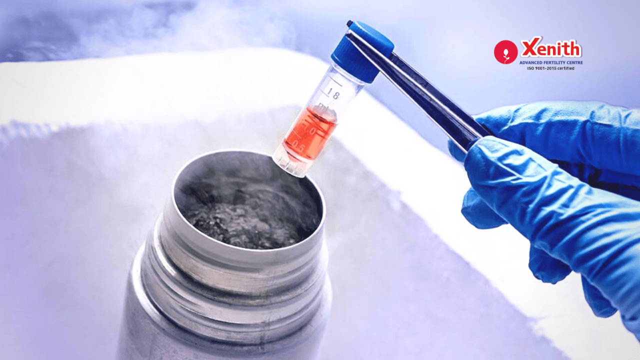 10 Most Common Questions about Egg Freezing for Later Pregnancy