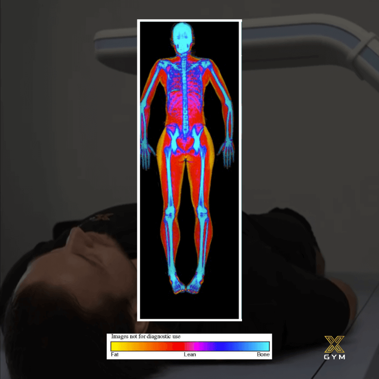 What DEXA Scans Tell You DEXA Scan Castle Hill XGYM
