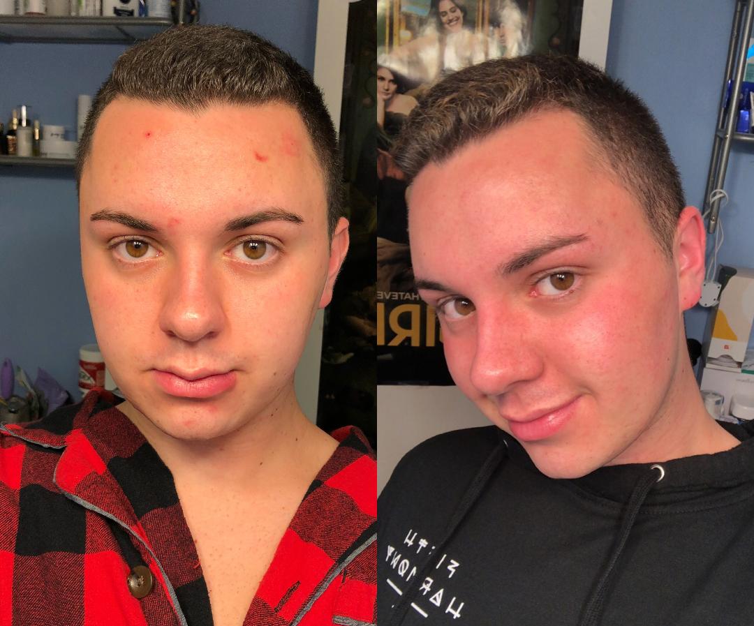 My Exact ‘goop’ Skin Care Regime (With Before and After Photos) XO Diva D