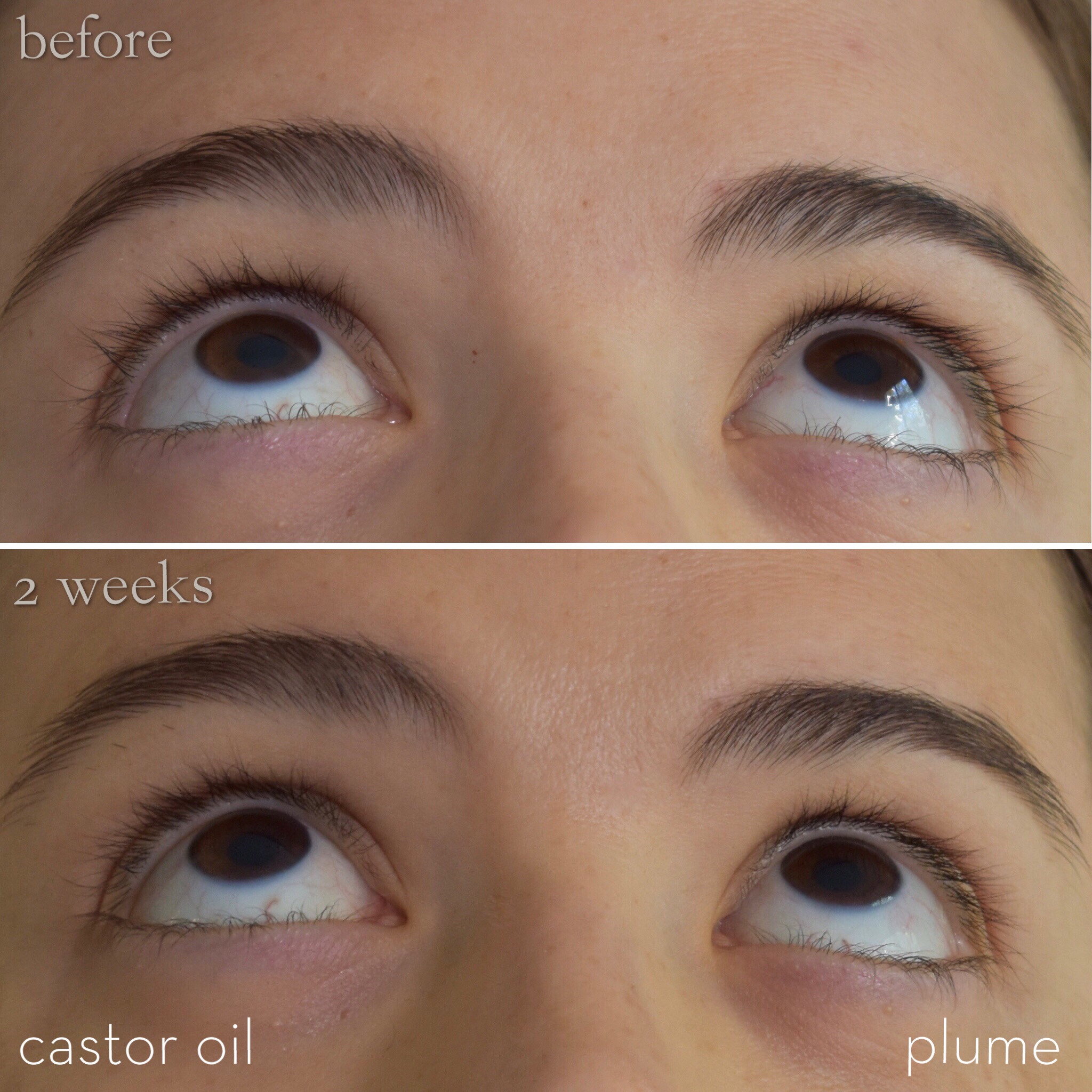 Castor Oil Eyelashes Before After