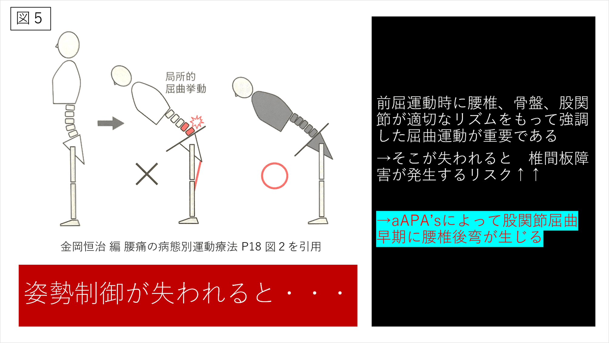 腰椎の安定性について ～運動学と解剖学の視点から考える～ XPERT