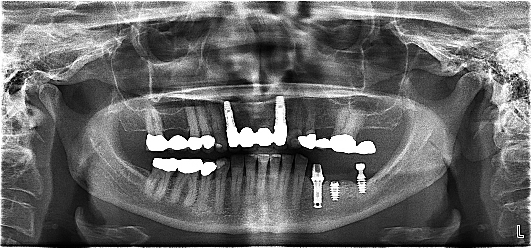 Hermanus Our Blog PAN XRAYS Xplorio™