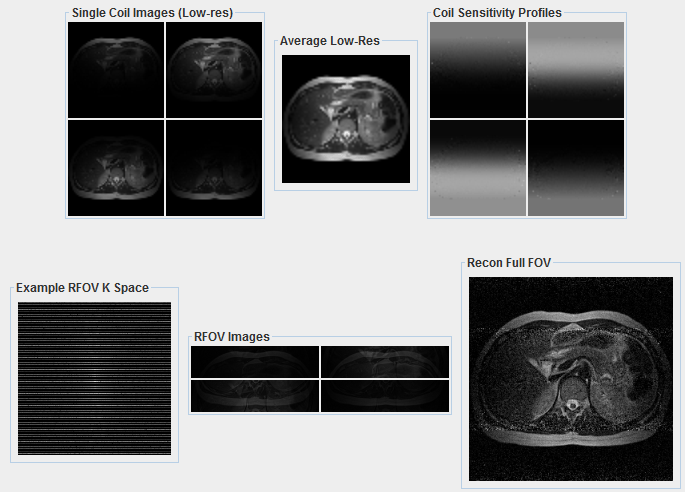How To Calculate Scan Time In Mri mri scan machine
