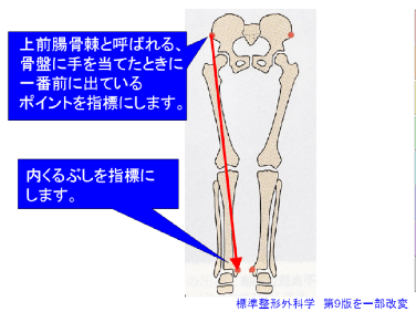 足の長さが違う⁉その原因は骨盤の歪み｜骨盤矯正ならTlcボディケア・整体サロン西新宿 | 公式Blog | Tlc整体＆ボディケア西新宿 ひざの整体 足の長さを整える 【芸能人が通う柏の『本当に治る』と評判の整体院】