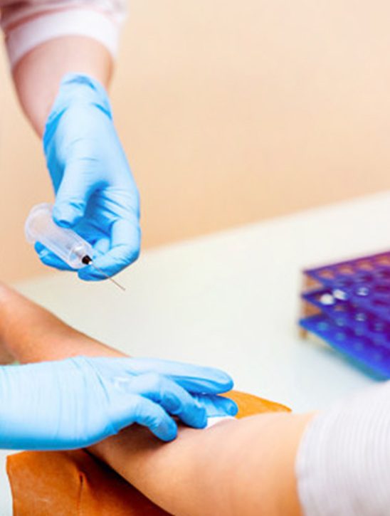 Blood Test Packages in Dubai YAH Polyclinic