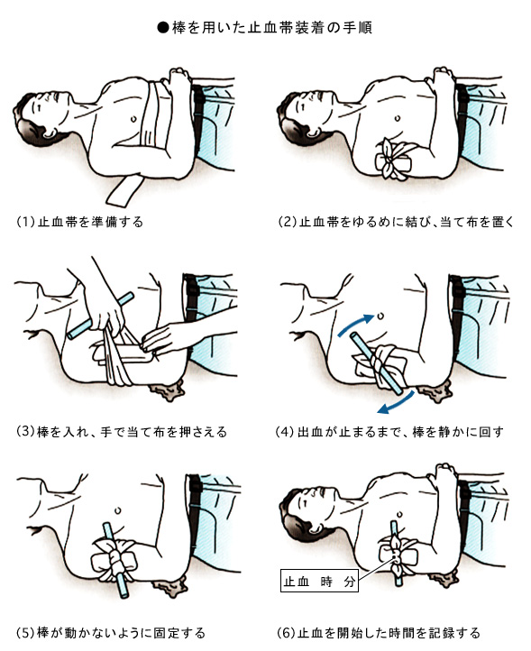 止血のしかた