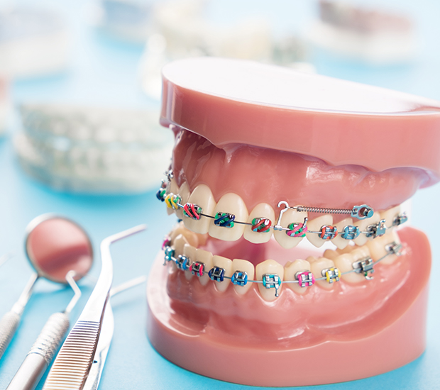 Jaw Alignment and Orthodontics Understanding the Connection Yang