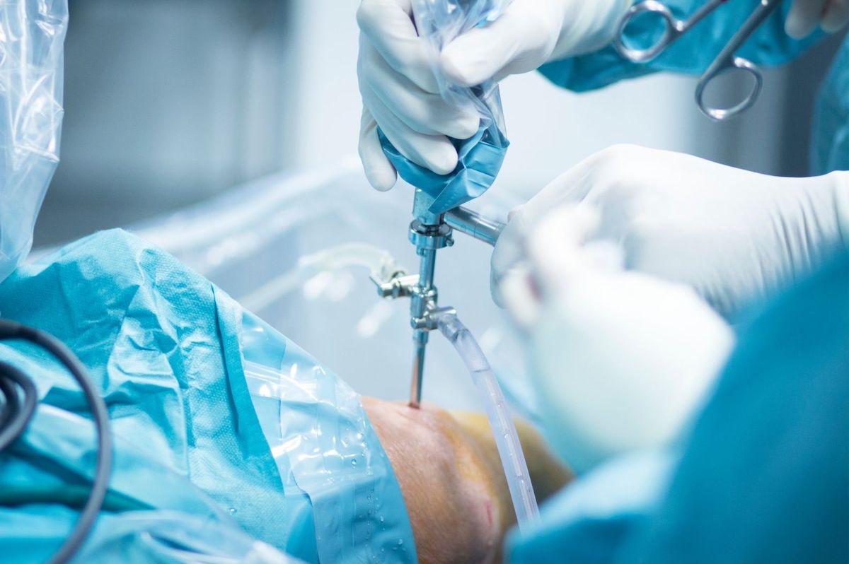 Orthopedic Surgery What Retractors Are Used? Yasui Co., Ltd.