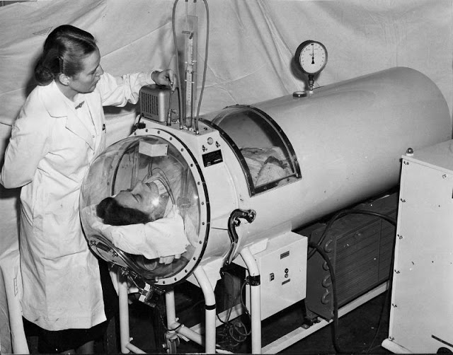 20 Vintage Photos of Iron Lungs for Polio Victims From Between the